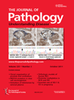 Journal of Pathology - June 2011